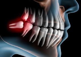 Cirurgia Bucomaxilofacial