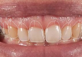 Odontologia Estética