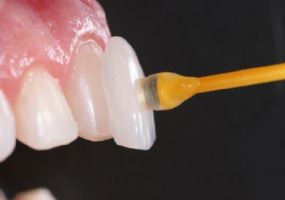 Odontologia Estética