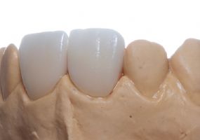 Prótese Dentária