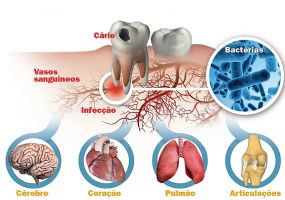 Endodontia