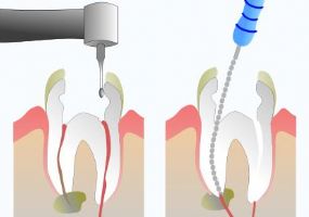 Endodontia